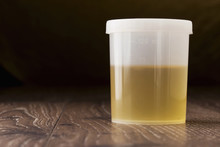 Jar Of Urine