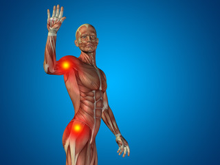 Poster - Conceptual human body anatomy pain on blue background