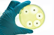 Antimicrobial susceptibility testing in petri dish
