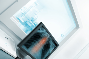 Wall Mural - Computer in the x-ray cabinet