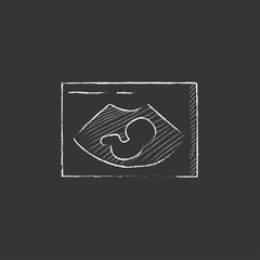 Poster - Fetal ultrasound. Drawn in chalk icon.