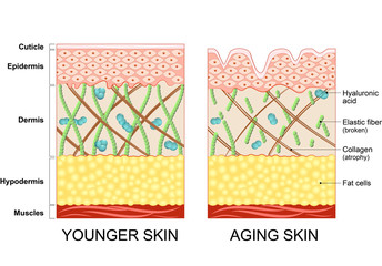 Poster - younger skin and older skin