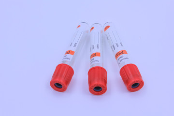 Medical test tube on white background