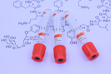 Medical test tube on white background