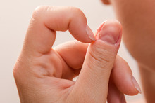 Injured Female Finger After Biting Nails