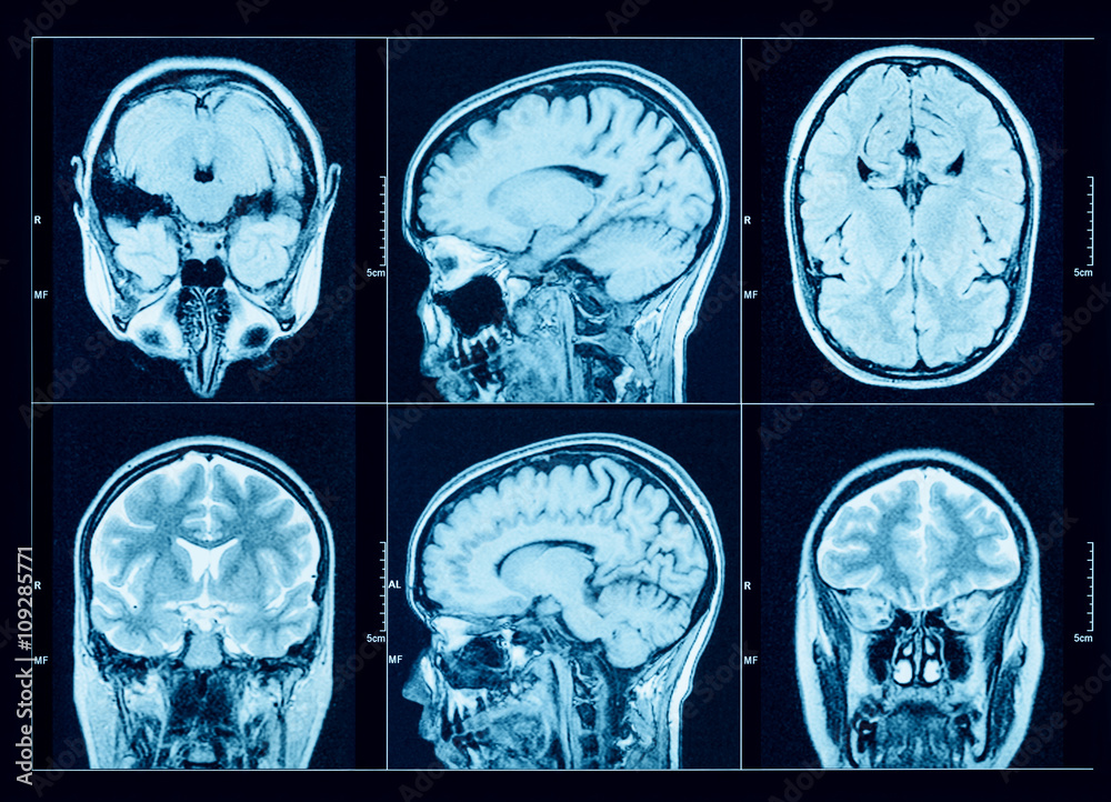 Closeup of a CT scan with brain Stock Photo | Adobe Stock