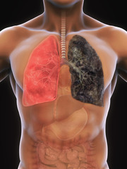 Wall Mural - Healthy Lung and Smokers Lung Illustration. 3D render