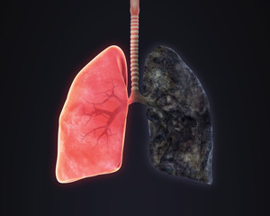 Wall Mural - Healthy Lung and Smokers Lung Illustration. 3D render