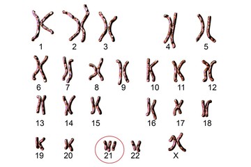 Wall Mural - Down-syndrome karyotype, female, labeled, isolated on white background. Trisomy 21. 3D illustration