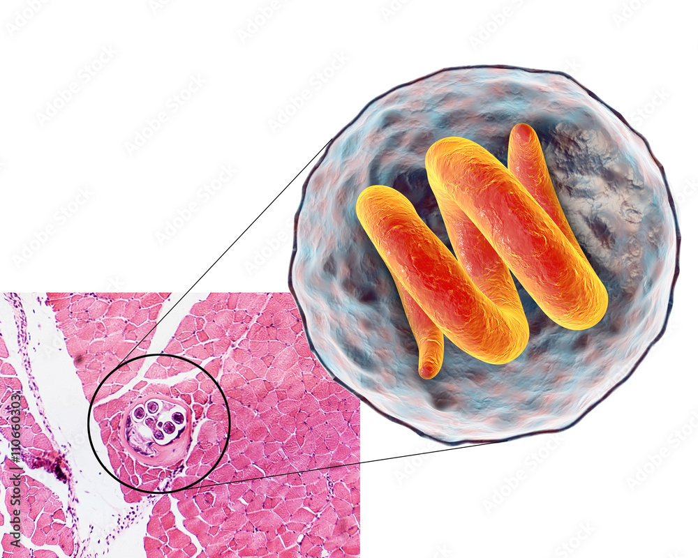 Meat Cyst Stock-Illustration „3D illustration and microphotograph (transverse ...
