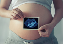 Pregnant Woman With Ultrasound Scan
