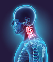 3D illustration of Cervical Spine, medical concept.