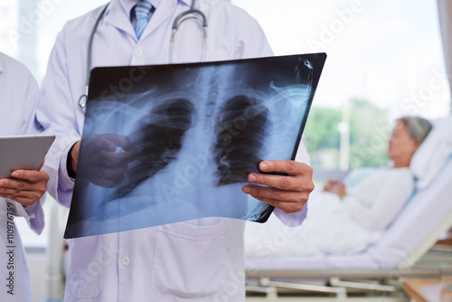 Fotografía Una radiografía de tórax en las manos del trabajador médico
