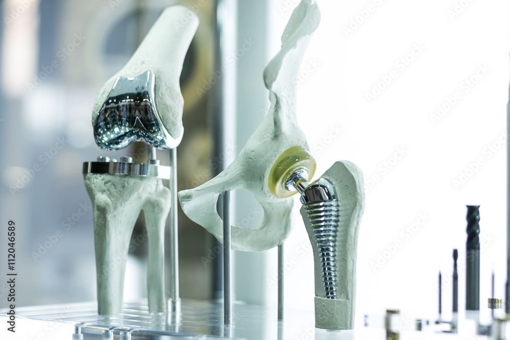 Modern knee and hip prosthesis made by cad engineer and manufactured by 3d printing - obrazy, fototapety, plakaty 