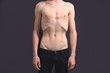 © Africa Studio - Skinny young man with anorexia on dark background