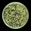 Colonies of bacteria from sea water on a petri dish ( agar ) isolated on black background.  At least four different colors bacterial species are presented. Focus on full depth.