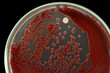 Bacterial colonies on an agar surface macro photo. Nutrient agar media contains small light grains. Focus on all agar surface. Isolated on a black background.