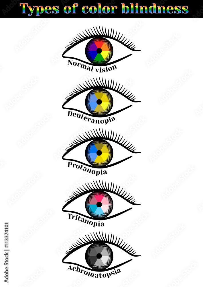Types of color blindness. Violation of color perception: deuteranopia ...