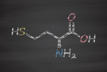 Canvas Print - Homocysteine (Hcy) biomarker molecule. 