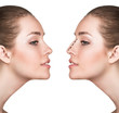 © Dmitrii Kotin - Woman before and after cosmetic nose surgery