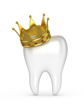 Human tooth with a gold crown on a white background. 3D illustra