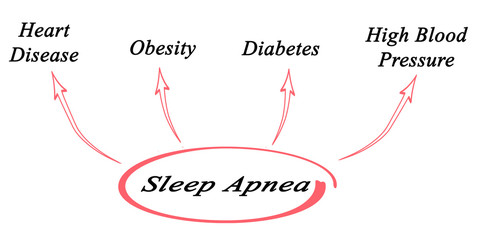 Wall Mural - Sleep Apnea