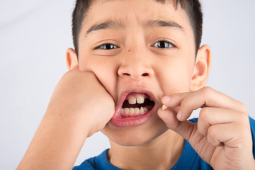 Wall Mural - Little boy showing baby teeth toothless close up waiting for new teeth