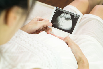 Pregnant asian woman looking at ultrasound scan of baby, close u