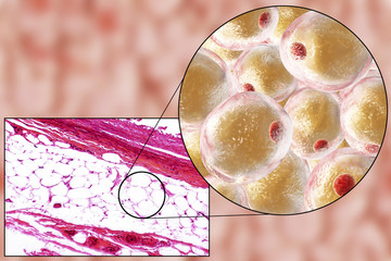 Wall Mural - White adipose tissue (fat cells), light micrograph and 3D illustration, hematoxilin and eosin staining, magnification 100x. Fat cells (adipocytes) have large lipid droplet which remains unstained