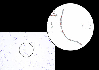 Canvas Print - Bacillus anthracis, light micrograph and 3D illustration, gram-positive spore forming bacteria which cause anthrax and are used as biological weapon