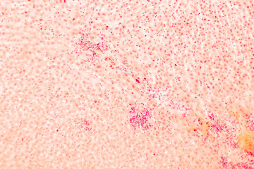 Sticker - Coccidiosis, coccidia in liver, light micrograph, magnification X50, unlabeled. Micrograph shows bile duct hyperplasia and fibrosis with periductal inflammation, groups of coccidia (in the center)