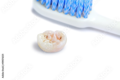 Fotografia, Obraz Dental caries and tooth brush on white background