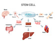 Using stem cells to treat disease