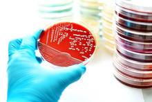 Bacteria Colonies In Blood Agar
