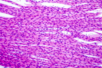 Sticker - Heart muscle, light micrograph. Striated cardiac muscle cells myocytes. Light microscopy, hematoxilin and eosin stain, magnification 200x