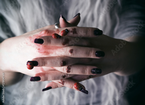 Fotografie, Obraz Manos de una mujer joven con heridas y sangre seca