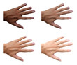 dark skin turn to white skin, whitening , 4 steps of uv protection , hand