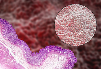 Poster - Pyloric mucosa, light micrograph and 3D illustration which show deep gastric pits reaching half of mucosa depth