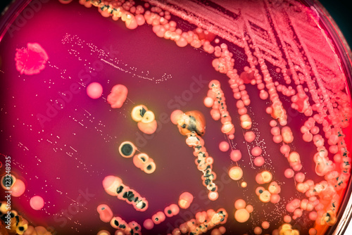 Fotografie, Obraz Bacterial colonies culture on selective agar media(SS agar).