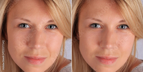 skincare for 30 year old woman