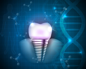 Sticker - Dental implant scientific design on a blue DNA background.