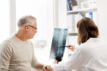 Sticker - doctor with spine x-ray and senior man at hospital