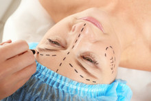Surgeon Hand Drawing Marks On Female Face For Plastic Operation