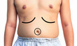 Overweight man body with hands touching belly fat - obesity conc