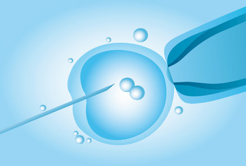 Microscopic artificial insemination, In vitro fertilisation (IVF