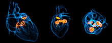 3d Render Illustration Of The Orange Heart Valve X-ray Collection