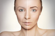 © transurfer - revitalization concept face before and after