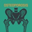 OSTEOPOROSIS vector logo icon design
