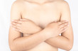 Scars from surgery breast