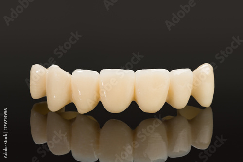 Fotografia, Obraz Crown seven elements on zirconium oxide, detail of the layering ceramic dental implant